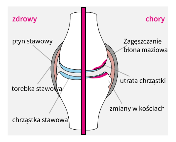 artroza u psa objawy)